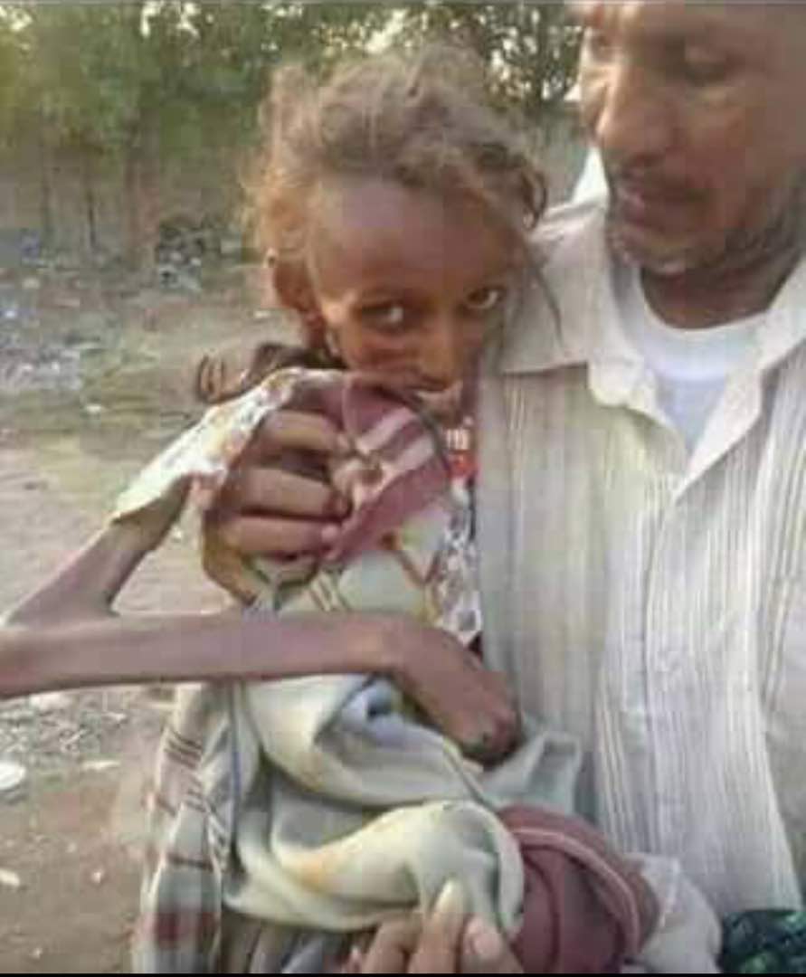ناشطون يحذرون من كارثة صحية في مدينة الحديدة ويناشدون انقاذ مدينتهم