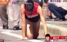 يابانية تكمل الماراثون بعد أن كسرت ساقها