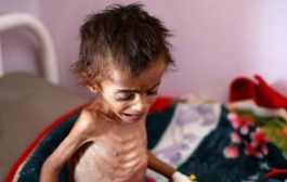 14 مليون شخص على شفا المجاعة خلال الأشهر القليلة المقبلة في اليمن