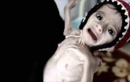 لوكوك: 14مليون مواطن مهددون بالمجاعة في اليمن
