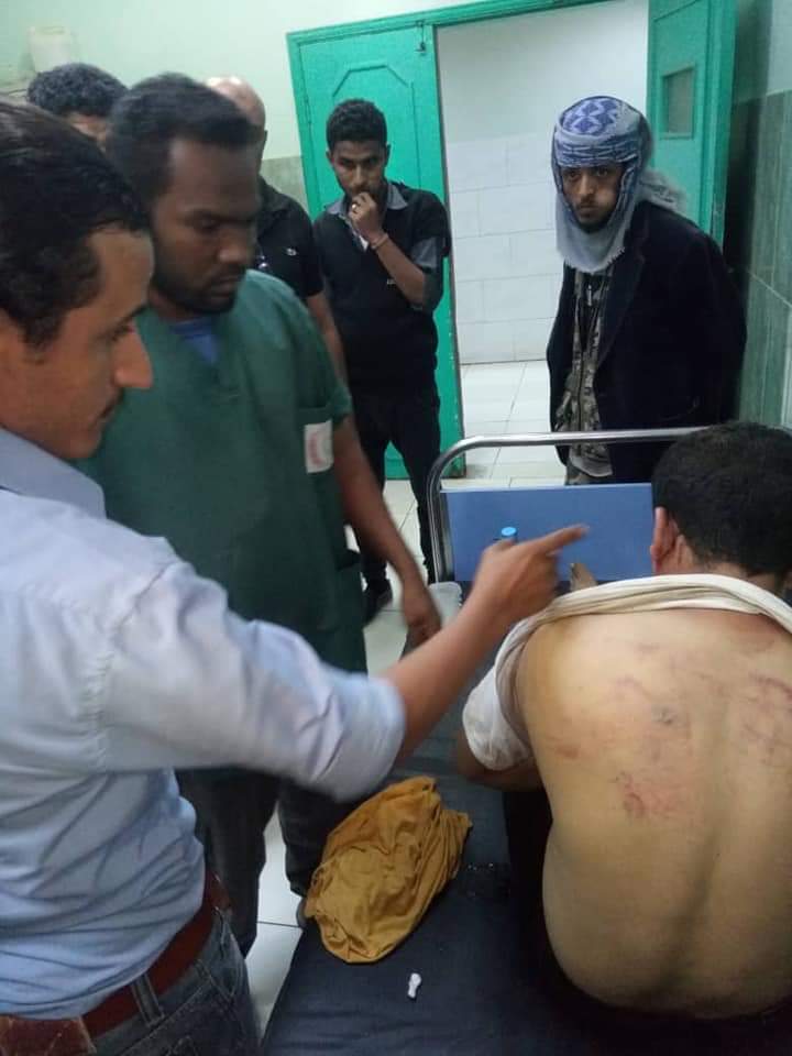 اختطاف رجل امن وتعذيبه في سجن سري بجزيرة العمال يتبع قوة الطوارئ التابعة لأمن عدن