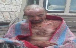 وكالة أمريكية تنقل شهادات مروعة عن تعذيب الحـوثيين لمعتقلين يمنيين