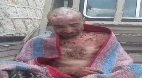وكالة أمريكية تنقل شهادات مروعة عن تعذيب الحـوثيين لمعتقلين يمنيين