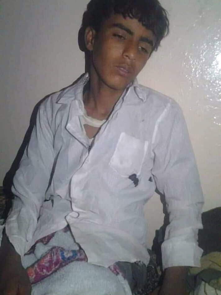 اختطاف طفل عمره 10 سنوات وتعذيبه في قسم شرطة نصاب محافظة شبوة