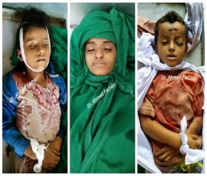 110 بين جريمة وانتهاك ارتكبتها مليشيات الحوثي خلال شهر ديسمبر في محافظة تعز