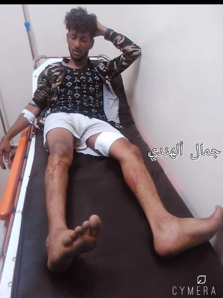 قتلى وجرحى مدنيين في قصف حوثي على حي سكني بتعز