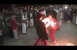 بالفيديو : احتراق صبي قدم عروضا بهلوانية بحفل زفاف في اليمن
