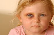 حوادث العيون عند الأطفال ..كيف تتصرف ؟