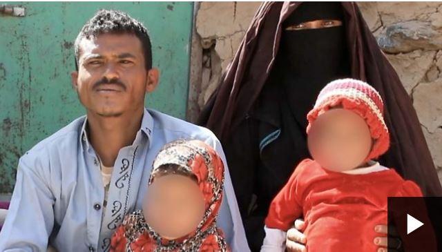 بسبب الجوع والحاجة يمني يعرض طفلتيه القاصرتين للزواج