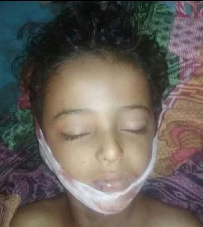 مليشيات الحوثي تقتل طفلا