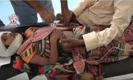 انتهاك حوثي جديد بحيس قذائف الهاون وإصابة مدنيين بمستشفى 