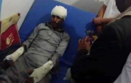 مشرف حوثي يعتدي بالضرب المبرح على ناشط حقوقي في ذمار