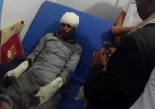مشرف حوثي يعتدي بالضرب المبرح على ناشط حقوقي في ذمار