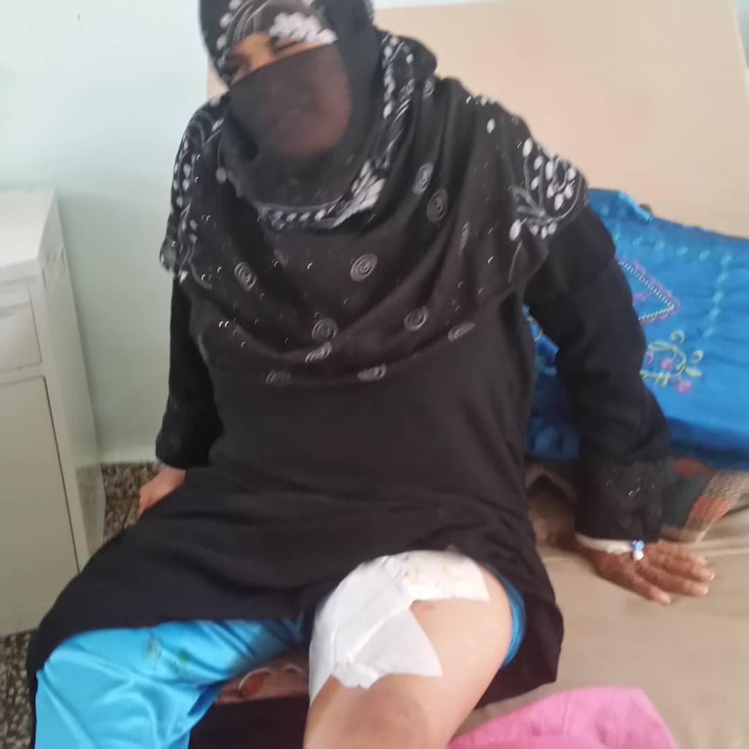 الضالع :  بعد ان قتلت امرأة واصابة اخرى ..  مليشيات الحوثي تقصف بصواريخ الكاتوشاء قرى حجر