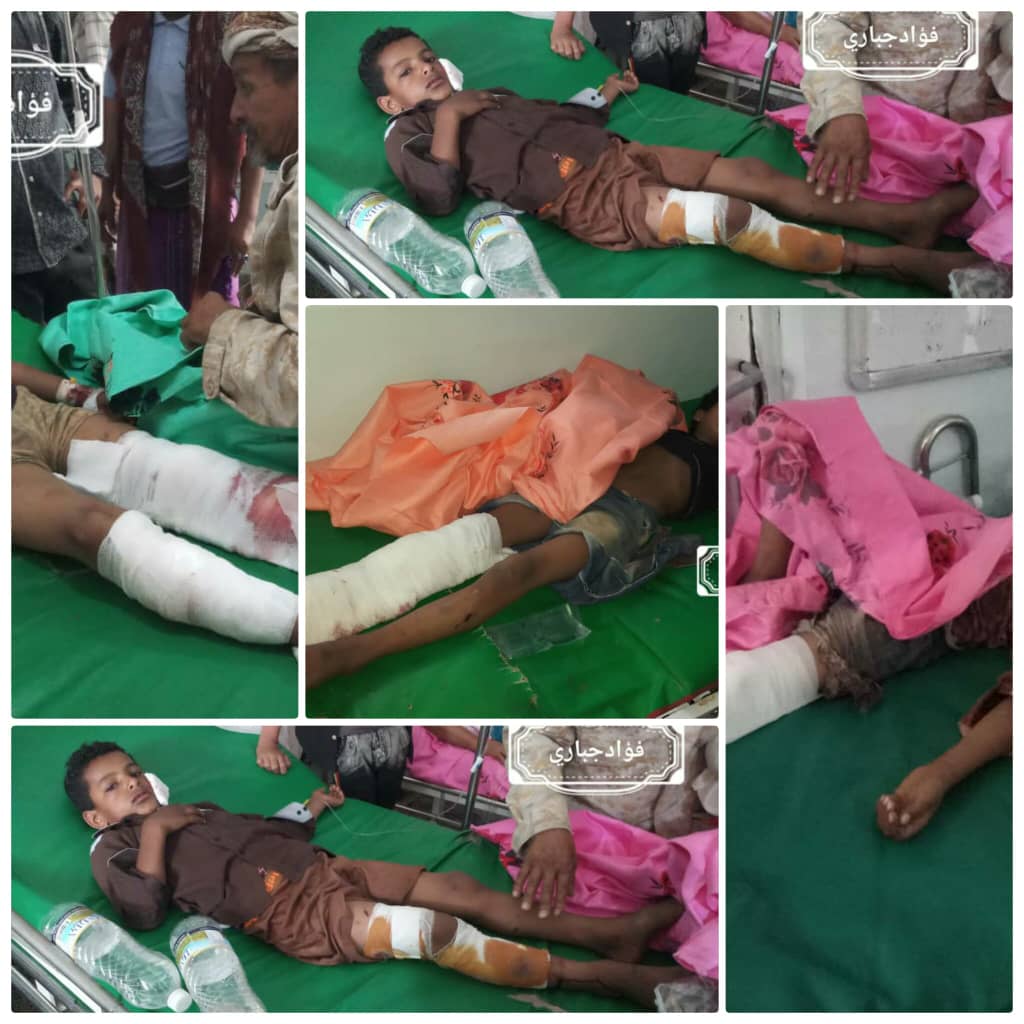 اصابة 4 اطفال في انفجار مقذوف من مخلفات مليشيات الحوثي بمنطقة مريس