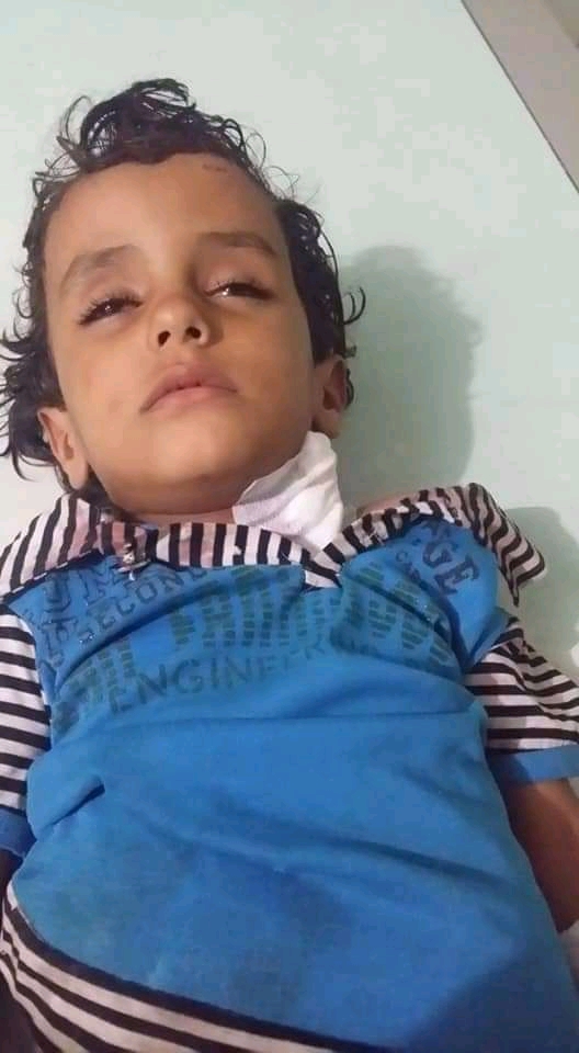 أصابة طفل بطلق ناري عند استهداف مليشيات الحوثي  قرية الشغادر وسط حجر