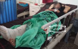 إصابة إمرأة حامل برصاصة قناص حوثي شمال غرب الضالع