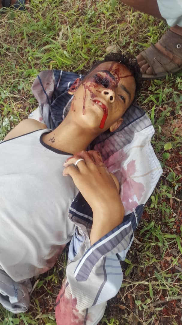 قناص حوثي ينهي حياة طفل شمال غربي لحج