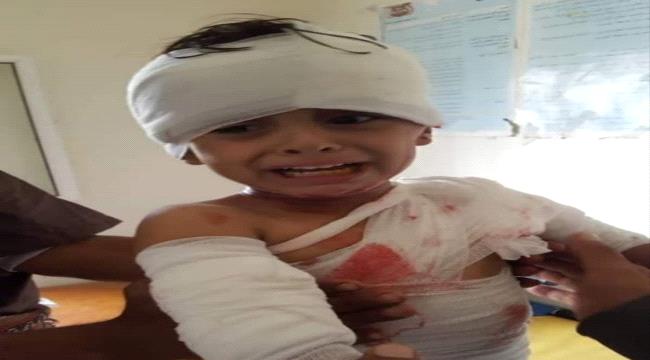 إصابة طفلان شقيقان بشظايا حوثية في البيضاء