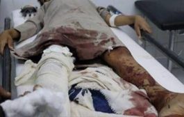 إصابة ثلاثة أطفال وشقيقتهم بقذائف الحوثيين في قعطبة