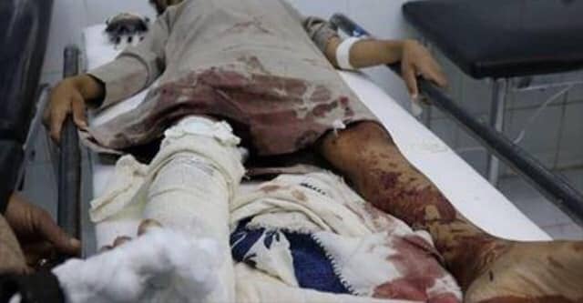 إصابة ثلاثة أطفال وشقيقتهم بقذائف الحوثيين في قعطبة