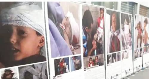 جرائم #الحـوثيين في معرض فوتوغرافي بجنيف