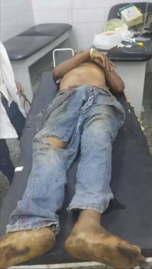 قيادة ميناء عدن توجه بالتحقيق في حادث تسبب في مصرع عامل بميناء المعلا