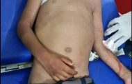 استشهاد طفل بقذيفة دبابة أطلقتها المليشيات الحوثية باتجاه قرية المشاريح بحجر