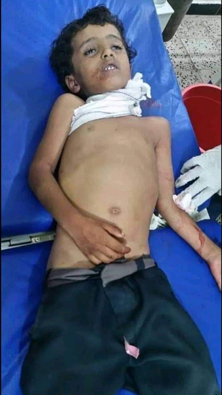 استشهاد طفل بقذيفة دبابة أطلقتها المليشيات الحوثية باتجاه قرية المشاريح بحجر