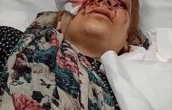 في حادثة عربية بشعة: أردني يقتلع عين زوجته أمام أطفالها