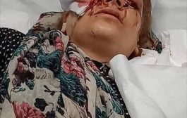 في حادثة عربية بشعة: أردني يقتلع عين زوجته أمام أطفالها