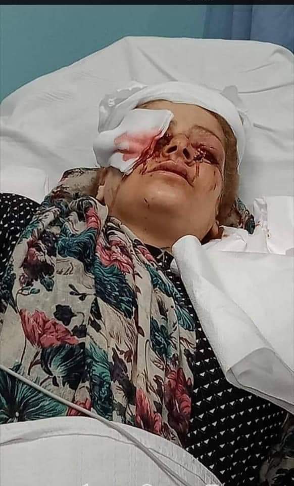 في حادثة عربية بشعة: أردني يقتلع عين زوجته أمام أطفالها