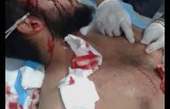 شاب يتعرض لحادثة طعن في عدن من قبل نساء