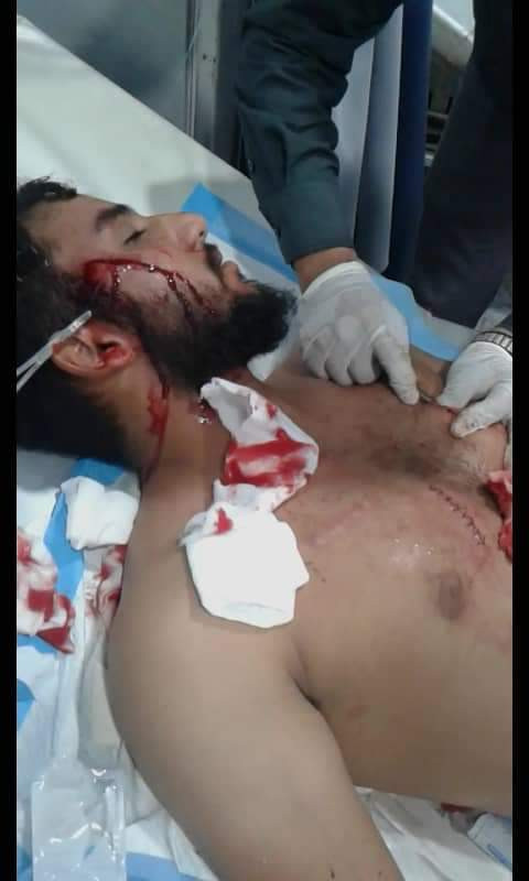 شاب يتعرض لحادثة طعن في عدن من قبل نساء