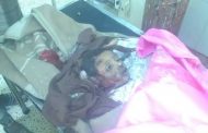 حادث مروري يودي بحياة طفل وعدد من الجرحى بخط طورالباحة عدن 