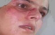 الحوثيون يقومون بضرب وتعذيب الناشطة ابتسام