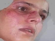 الحوثيون يقومون بضرب وتعذيب الناشطة ابتسام