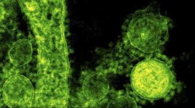 منظمة الصحة العالمية تعلن ان فيروس كورونا ليس وباء وتم تحديد تسلسله الجيني