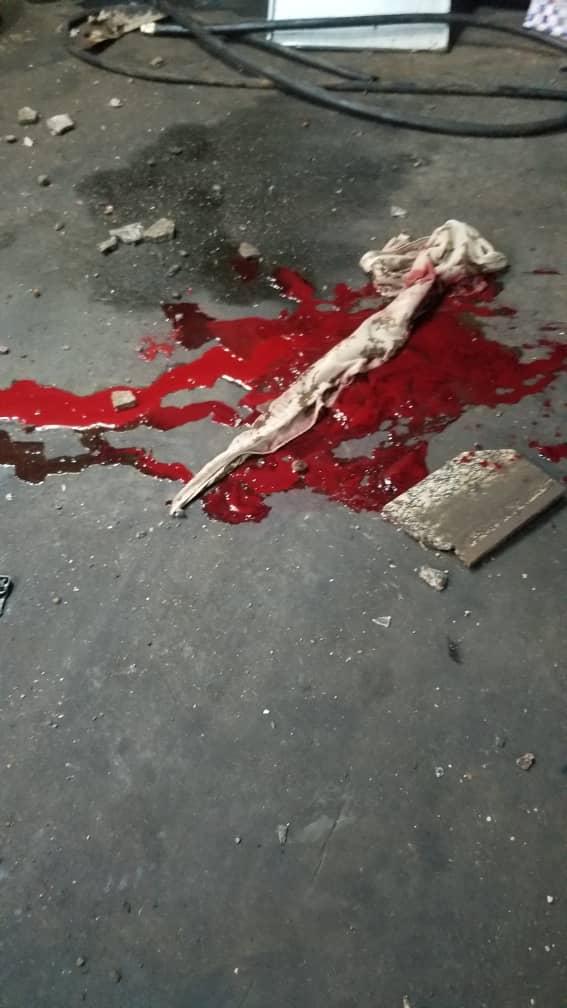 تفاصيل جديدة حول حادثة انقلاب الطقم العسكري بزفة العرس بحوطة لحج