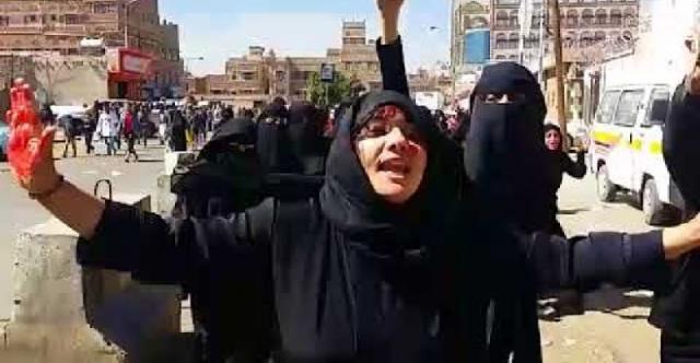 منظمة رايتس رادار  15 ألف انتهاك ارتكبتها مليشيا الحوثية