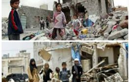 جحيم حي.. واقع الحرب المؤلم في اليمن