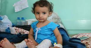 في يوم واحد صنعاء تسجل 500 إصابة بمرض الكوليرا