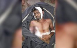 وفاة مختطف تحت التعذيب في معتقل لمليشيات الحوثي بالحوبان