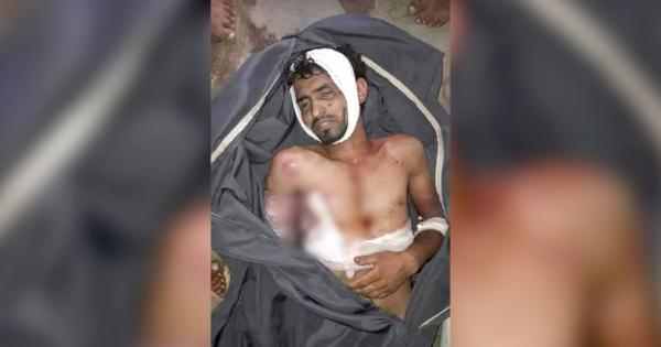 وفاة مختطف تحت التعذيب في معتقل لمليشيات الحوثي بالحوبان