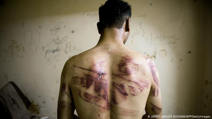 المقرر الأممي المعني بقضايا التعذيب: 