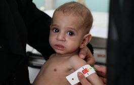 تحذيرات من تفاقم أزمة سوء التغذية في اليمن
