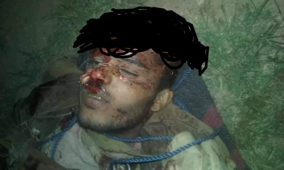 مصرع قائد عمليات وعدد من العناصر الحوثية تجاه معسكر الجب