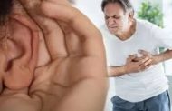 علاقة تجعد شحمة الأذن بالإصابة بنوبة قلبية