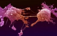 ابتكار مادة تزيد فاعلية العلاج الكيميائي لسرطان الرحم