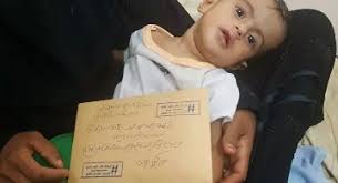 وزير الصحة يكشف عن ١٦ حالة شلل للأطفال ..محملاً  جماعة الحوثي تفشي الفيروس من جديد